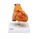 흉선이 있는 심장 인체 모형